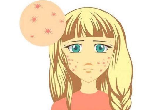 吃毛瓜长痘吗,毛瓜食用与痘痘关系探究